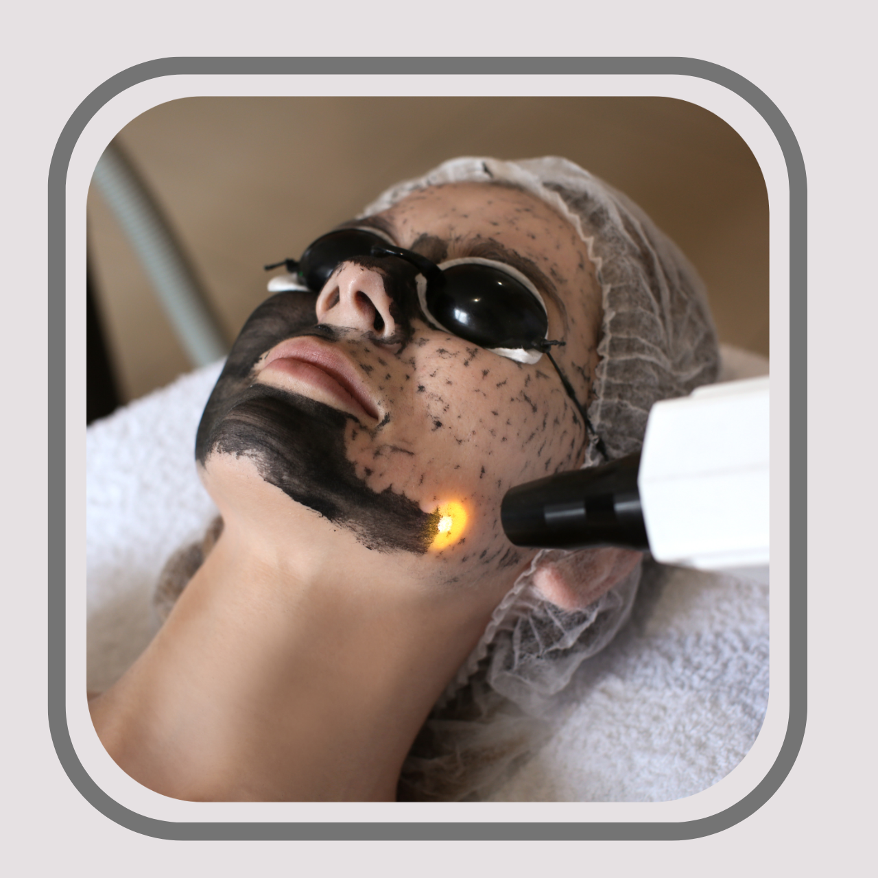 Black Diamond Laser Treatment™