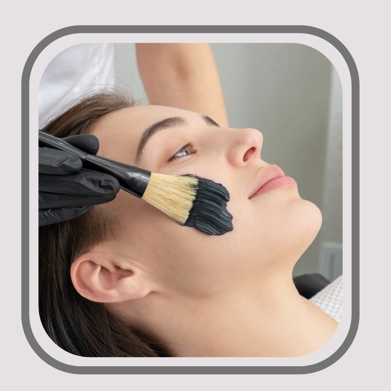 Black Diamond Laser Treatment™