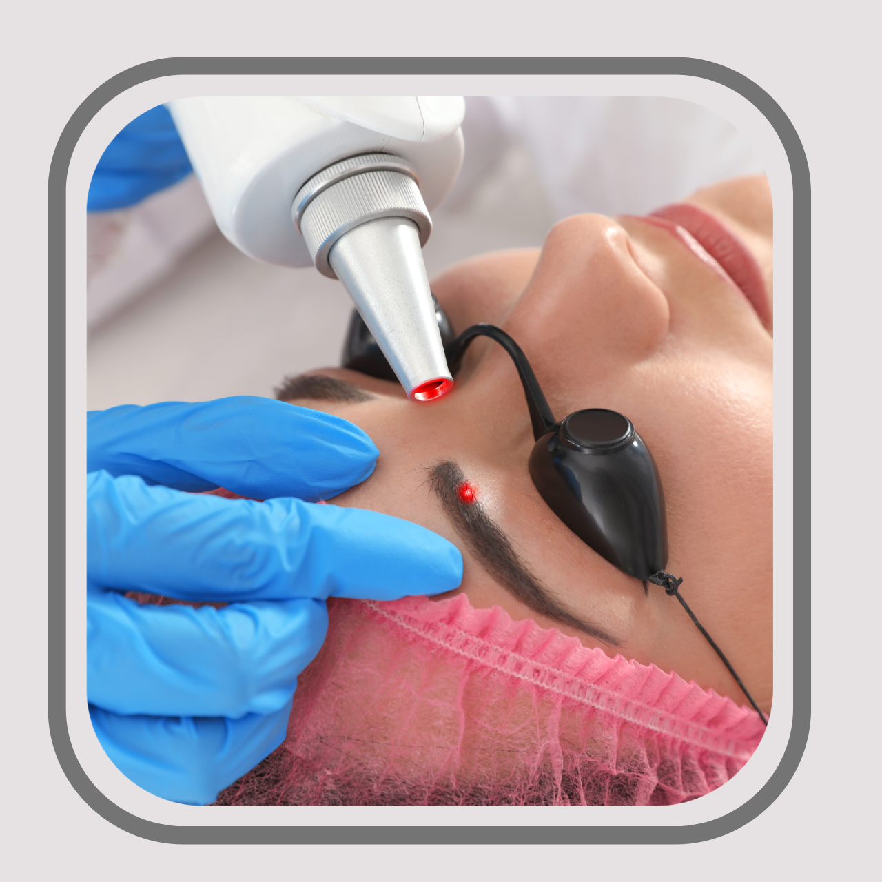 Tattoo Laser Removal -Starting from R200 per session