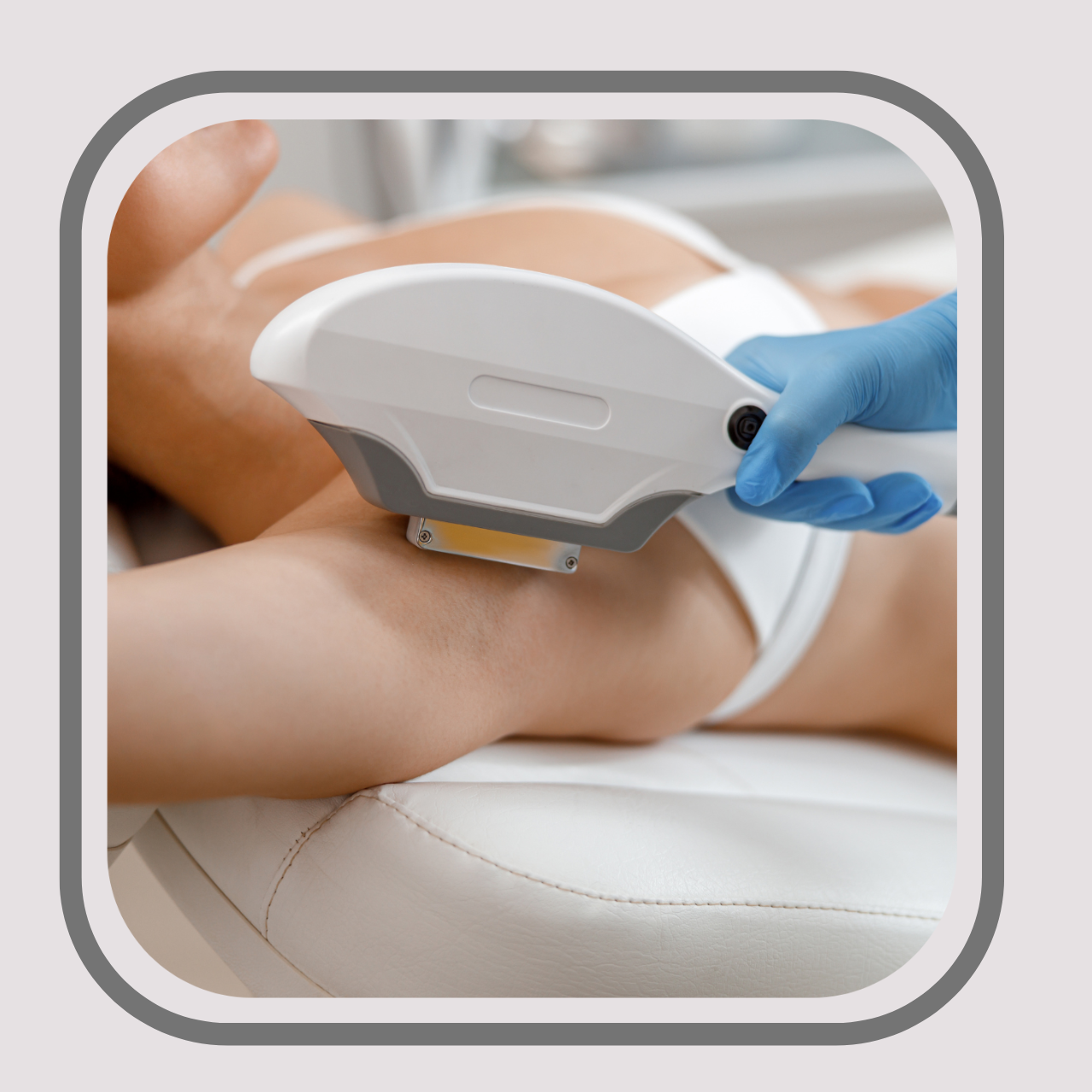 Hair Removal (E-Light & SHR)